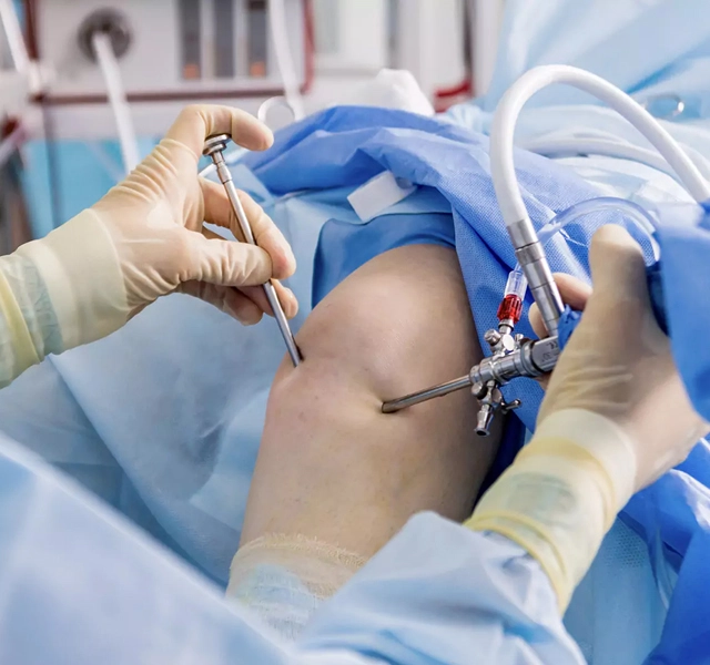 Arthroscopy