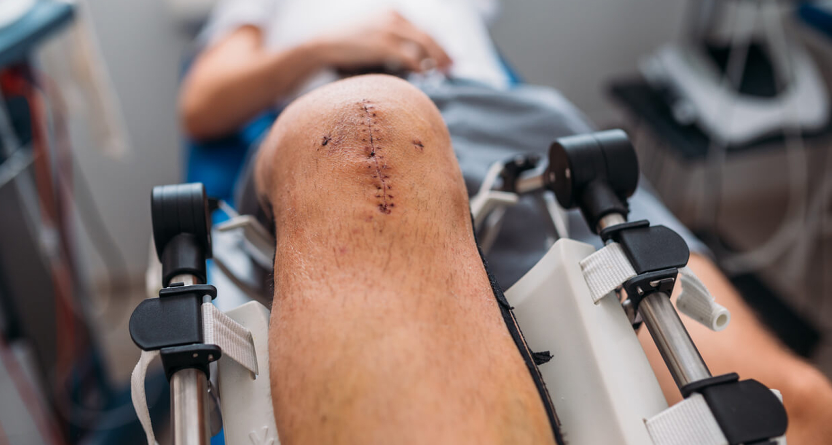 Hip-Knee-Replacement-Inner